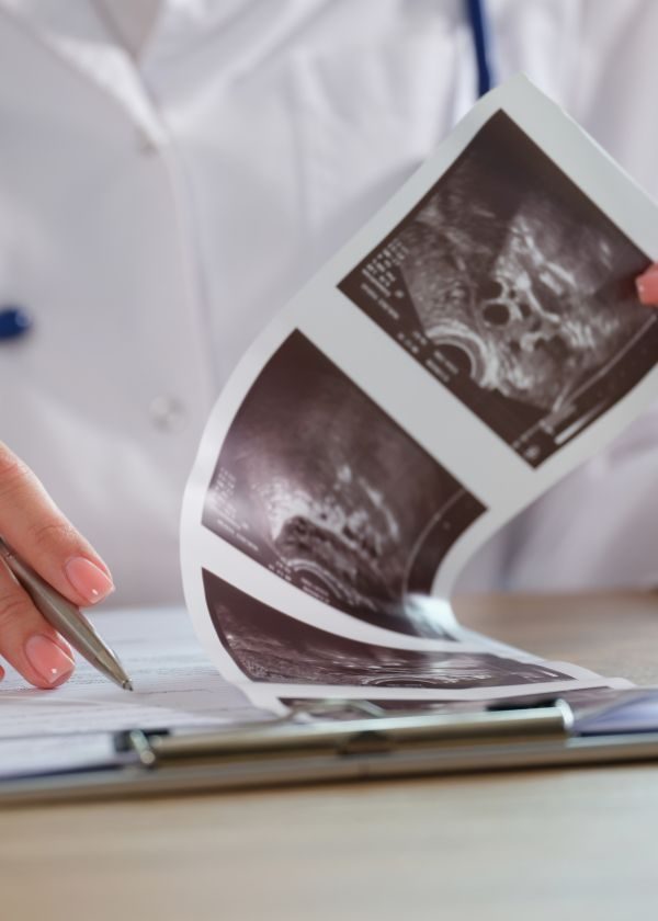 Doctor holding ultrasound images