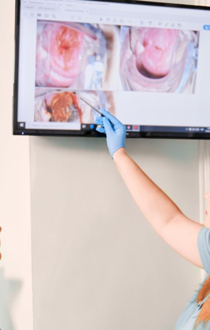 Practitioner pointing to colposcopy images on a screen