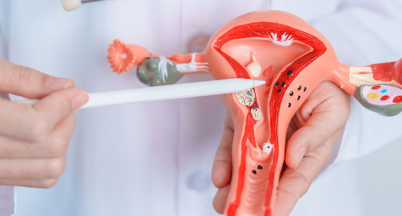 Doctor pointing to the endometrium on an anatomical model of the uterus