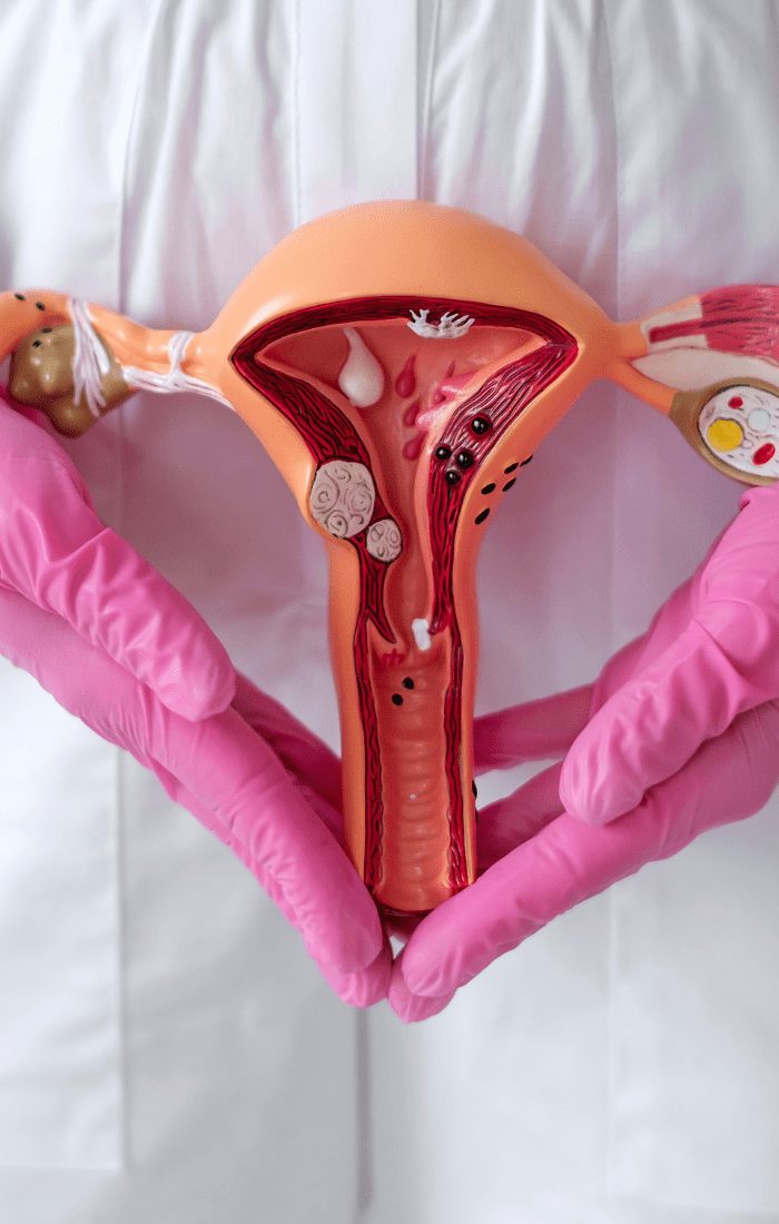 Gloved hands holding an anatomical model of the uterus