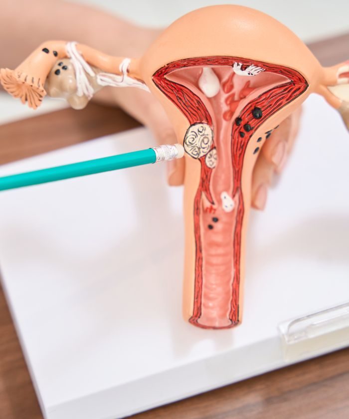 Anatomical model of the uterus on a desk
