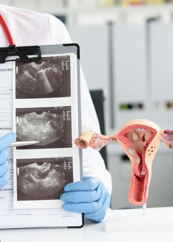 Doctor holding an ultrasound image and a model of the uterus