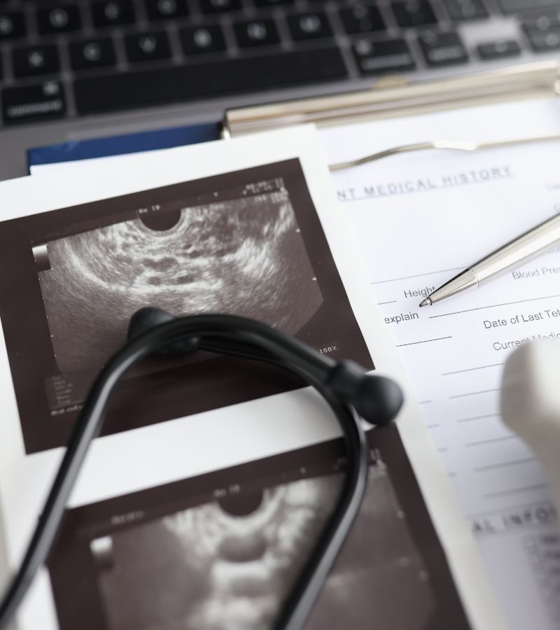 Stethoscope resting on ultrasound images