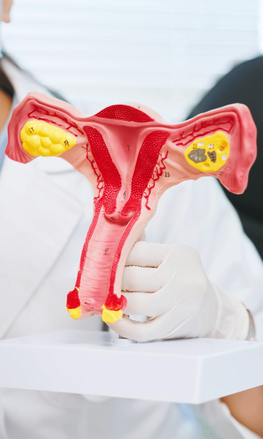 Gloved hand holding an anatomical model of the uterus and ovaries