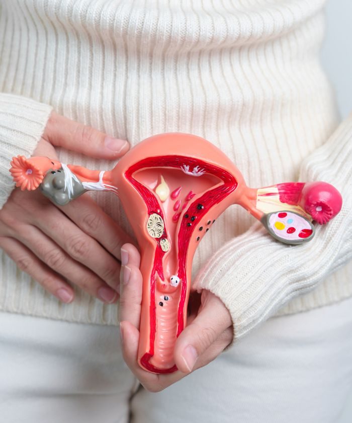 Woman holding a model of the uterus in front of her pelvis