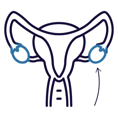 Diagram of the uterus, ovaries in blue