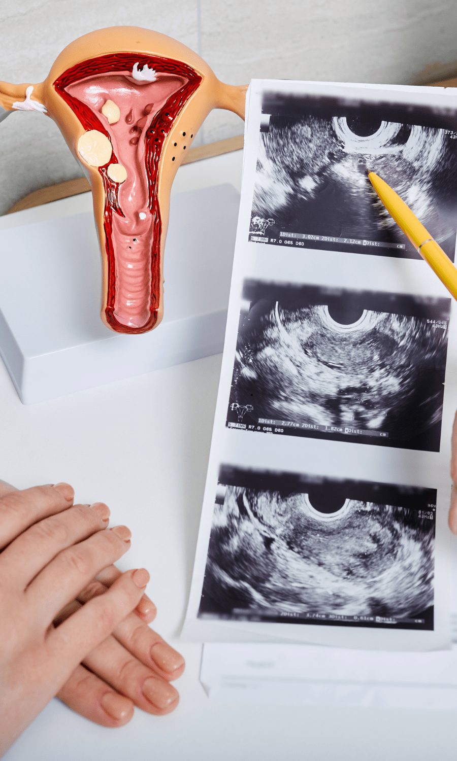 Model of the uterus and ultrasound images on a desk